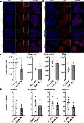 Improved contractile potential in detrusor microtissues from pediatric patients with end stage lower urinary tract dysfunction